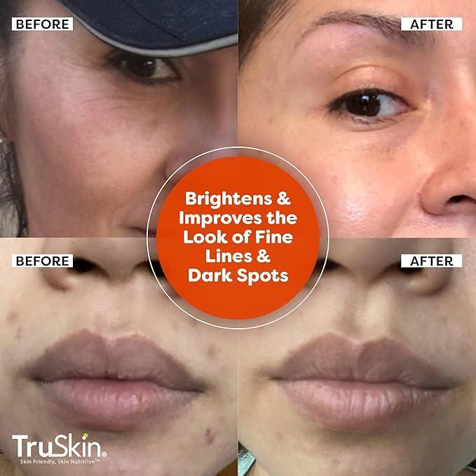 TruSkin Vitamin C Serum For Face – Anti Aging Formula with Vitamin C, Hyaluronic Acid, Vitamin E – Brightening Serum – Improve Appearance of Dark Spots, Tone, Fine Lines & Wrinkles, 1 Fl Oz - Which Mark
