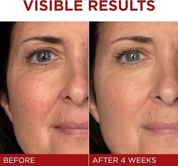 L'Oréal Paris Day Cream, Reduces Look of Wrinkles & Firms Skin, with Pro-Retinol, Vitamin C & Hyaluronic Acid, Revitalift Triple Power LZR, 50ml - Which Mark
