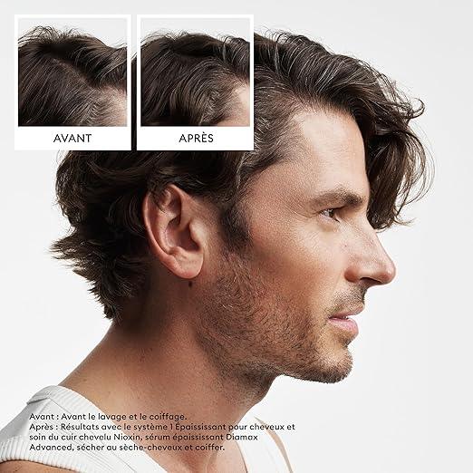 Nioxin Scalp + Hair Thickening System Kits | For Natural, Colored, & Damaged Hair with Light to Progressed Thinning | Strengthen & Boost Hair Density with Niacinamide & Biotin | Trial Size | 1 Month Supply - Which Mark