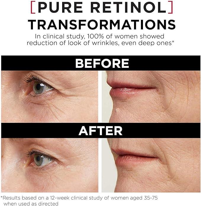 L’Oréal Paris Night Retinol Serum for Face, Revitalift Triple Power LZR, With 0.3% Pure Retinol, Moisturizes Skin and Eliminates Look of Deep Wrinkles, Skincare, 30 ml Climate Pledge Friendly - Which Mark