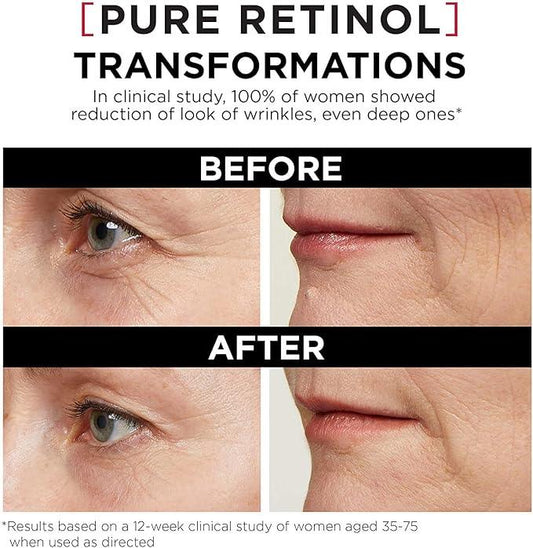 L’Oréal Paris Night Retinol Serum for Face, Revitalift Triple Power LZR, With 0.3% Pure Retinol, Moisturizes Skin and Eliminates Look of Deep Wrinkles, Skincare, 30 ml Climate Pledge Friendly - Which Mark