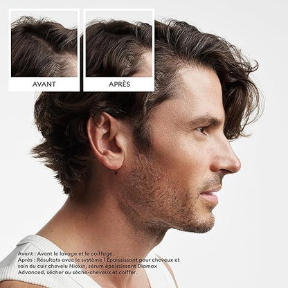 Nioxin Scalp + Hair Thickening System Kits | For Natural, Colored, & Damaged Hair with Light to Progressed Thinning | Strengthen & Boost Hair Density with Niacinamide & Biotin | Trial Size | 1 Month Supply - Which Mark
