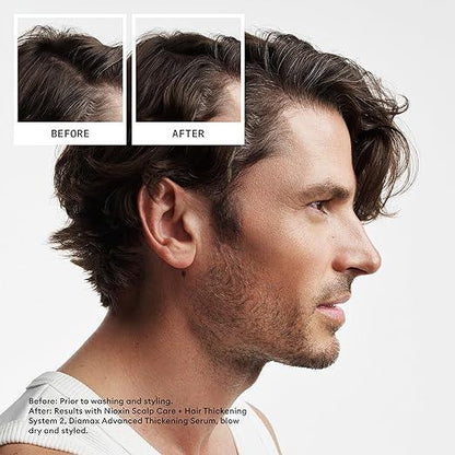Nioxin Scalp + Hair Thickening System Kits | For Natural, Colored, & Damaged Hair with Light to Progressed Thinning | Strengthen & Boost Hair Density with Niacinamide & Biotin | Trial Size | 1 Month Supply - Which Mark