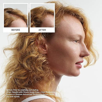 Nioxin Scalp + Hair Thickening System Kits | For Natural, Colored, & Damaged Hair with Light to Progressed Thinning | Strengthen & Boost Hair Density with Niacinamide & Biotin | 3 Month Supply - Which Mark