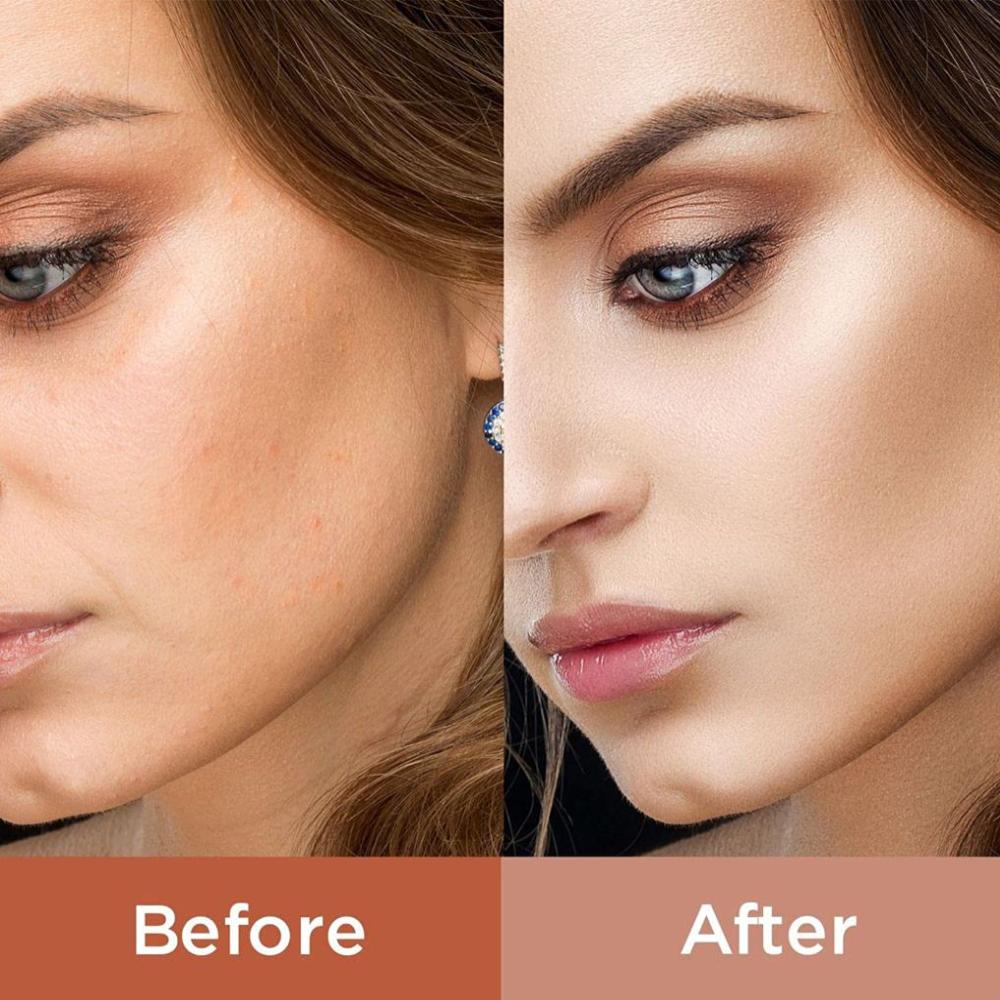 Platinum Gold Red Light Therapy - Which Mark
